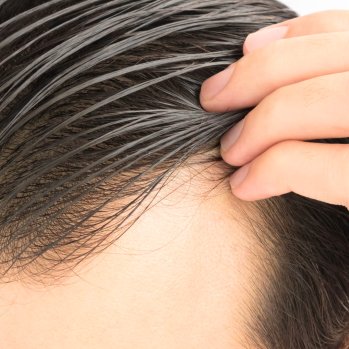 How to Fix Greasy Hair: Step-by-Step Guide (2026)